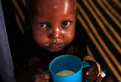 Açlığın korkunç yüzü Somali’de!